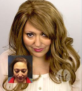 Custom Women's Hair Replacement - Pittsburgh PA